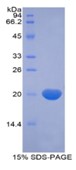 SDS-PAGE (RXFP1-6983H).jpg